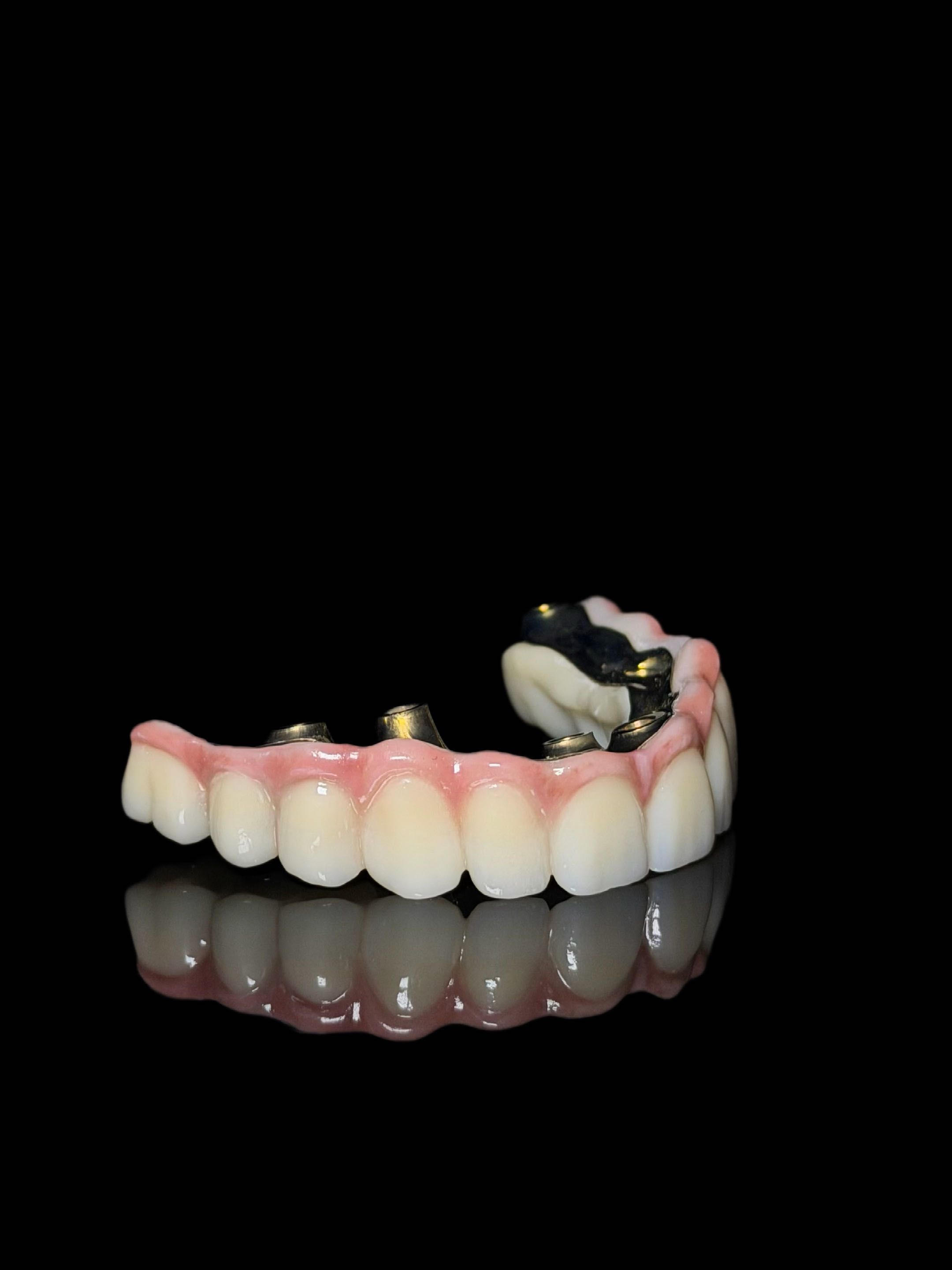 Конструкции върху импланти