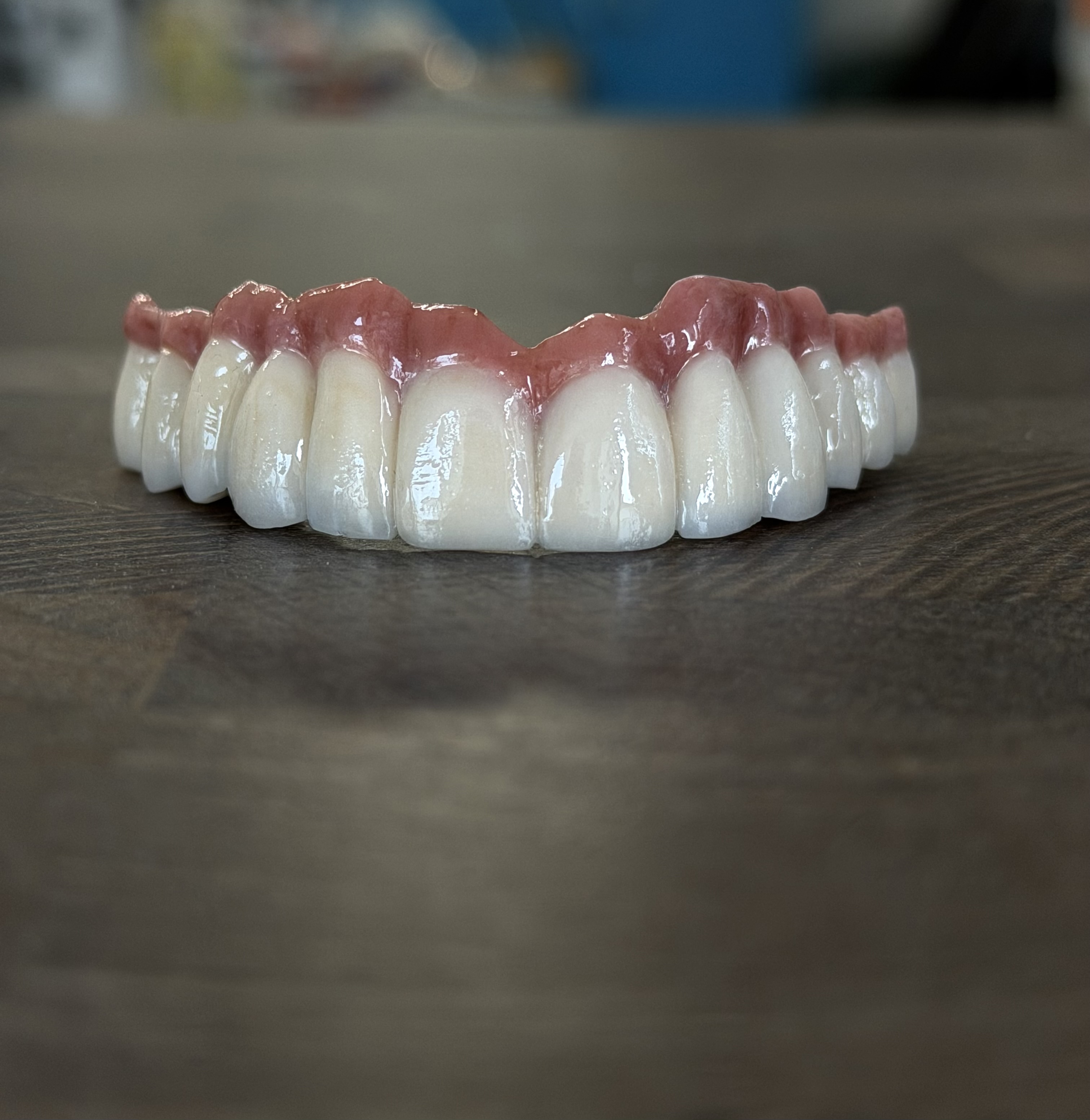 Зъбна Керамика