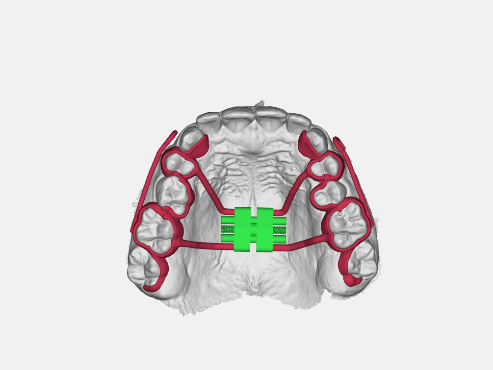 Ортодонтия